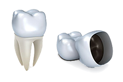Crowns | General Dentistry of Cape Cod | Dentist Hyannis, MA