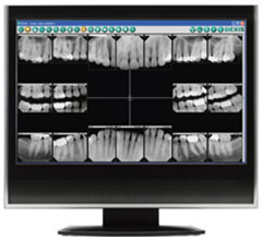 Digital Dental X-Rays | General Dentistry of Cape Cod | Dentist Hyannis, MA
